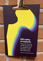 MRI safety of implants: measurement and model-based tools for validation and calculation of RF field interactions ISBN: 9789038655260 - Title: MRI safety of implants: measurement and model-based tools for validation and calculation of RF field interactions